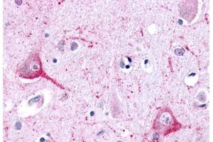 Anti-LPHN2 antibody  ABIN1049024 IHC staining of human brain, neurons and glia. (LPHN2 Antikörper  (N-Term))