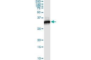 Immunoprecipitation (IP) image for anti-RPTOR Independent Companion of mTOR, Complex 2 (RICTOR) (AA 1-98) antibody (ABIN566975)