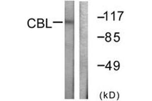 Western Blotting (WB) image for anti-Cas-Br-M (Murine) Ecotropic Retroviral Transforming Sequence (CBL) (AA 740-789) antibody (ABIN2888650) (CBL Antikörper  (AA 740-789))