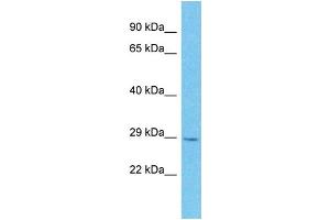 Western Blotting (WB) image for anti-MOB1, Mps One Binder Kinase Activator-Like 2C (MOBKL2C) (Middle Region) antibody (ABIN2791664) (MOBKL2C Antikörper  (Middle Region))