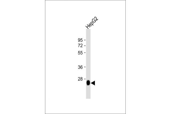 DHRS2 Antikörper  (C-Term)