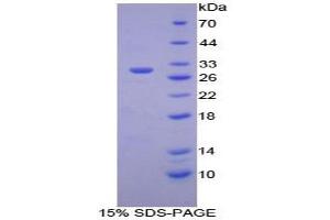 SDS-PAGE analysis of Human IkBz Protein. (Inhibitory Subunit of NF-KappaB zeta Protein)