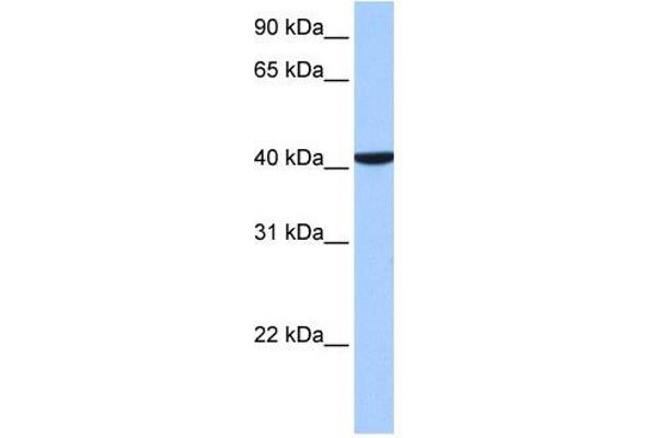 CC2D1B Antikörper  (C-Term)