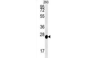 Western Blotting (WB) image for anti-Peroxiredoxin 6 (PRDX6) antibody (ABIN3001724) (Peroxiredoxin 6 Antikörper)