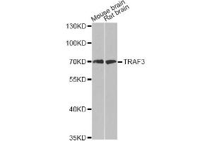 Western blot analysis of extracts of various cell lines, using TRAF3 antibody (ABIN5970321) at 1/500 dilution. (TRAF3 Antikörper)
