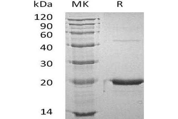 Growth Hormone 1 Protein (GH1)