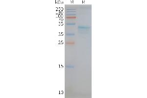 CCR5 Protein