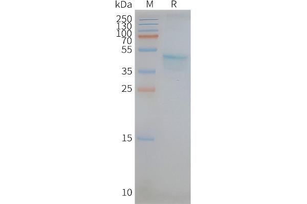 CCR5 Protein