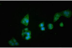 Immunofluorescent analysis of PC-3 cells using ABIN7149984 at dilution of 1:100 and Alexa Fluor 488-congugated AffiniPure Goat Anti-Rabbit IgG(H+L) (DPP4 Antikörper  (AA 473-588))