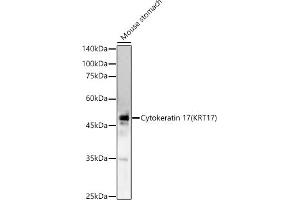 Western blot analysis of extracts of Mouse stomach, using Cytokeratin 17 (KRT17) antibody (ABIN6130112, ABIN6143023, ABIN6143024 and ABIN6213626) at 1:1298 dilution. (KRT17 Antikörper  (AA 133-432))