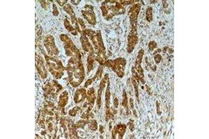 Immunohistochemical analysis of Alpha-tubulin (AcK40) staining in human breast cancer,mouse brain formalin fixed paraffin embedded tissue section. (alpha Tubulin Antikörper  (acLys40))