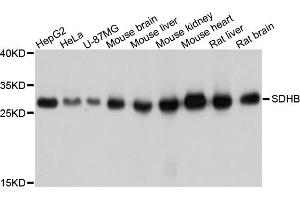 Western blot analysis of extracts of various cell lines, using SDHB antibody (ABIN5998756) at 1/1000 dilution. (SDHB Antikörper)