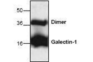 Image no. 1 for anti-Lectin, Galactoside-Binding, Soluble, 1 (LGALS1) antibody (ABIN127228) (LGALS1/Galectin 1 Antikörper)