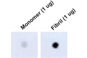 Dot Blot analysis using Mouse Anti-Tau Monoclonal Antibody, Clone 1D5 (ABIN6952077). (tau Antikörper  (Atto 594))