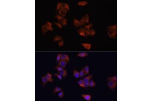 Immunofluorescence analysis of HeLa cells using L antibody (ABIN6130048, ABIN6143079, ABIN6143080 and ABIN6215226) at dilution of 1:100. (LAMP1 Antikörper  (AA 80-280))