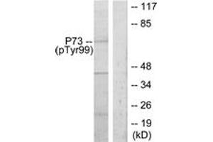 Western Blotting (WB) image for anti-Tumor Protein P73 (TP73) (pTyr99) antibody (ABIN2888508) (Tumor Protein p73 Antikörper  (pTyr99))