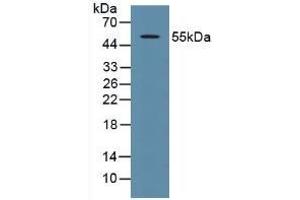 Detection of P53 in Human 293T Cells using Polyclonal Antibody to Tumor Protein p53 (P53) (p53 Antikörper  (AA 134-387))