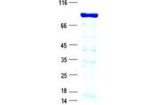 ZNF263 Protein (His tag)