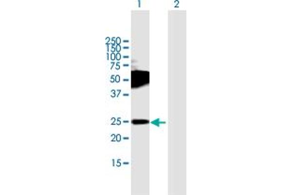 TMEM123 Antikörper  (AA 1-208)