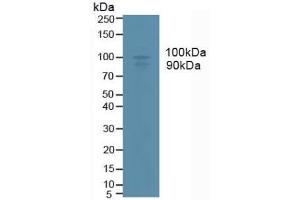 Western Blotting (WB) image for ADAM Metallopeptidase Domain 17 (ADAM17) ELISA Kit (ABIN6730919)