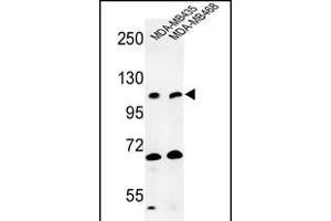 Western blot analysis of EXTL3 Antibody (N-term) (ABIN652990 and ABIN2842629) in MDA-M, MDA-M cell line lysates (35 μg/lane). (EXTL3 Antikörper  (N-Term))