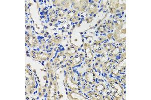 Immunohistochemistry of paraffin-embedded mouse kidney using SCG3 antibody. (SCG3 Antikörper)