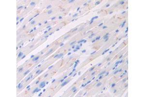 Used in DAB staining on fromalin fixed paraffin- embedded heart tissue (FLRT2 Antikörper  (AA 300-517))