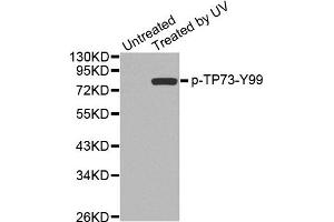 Western Blotting (WB) image for anti-Tumor Protein P73 (TP73) (pTyr99) antibody (ABIN1870690) (Tumor Protein p73 Antikörper  (pTyr99))