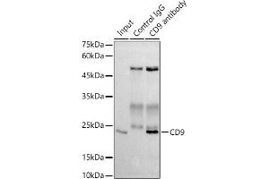 Immunoprecipitation analysis of 300 μg extracts of THP-1 cells using 3 μg CD9 antibody (ABIN7266227). (CD9 Antikörper)