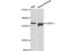 Western blot analysis of extracts of various cell lines, using CARD11 antibody. (CARD11 Antikörper)