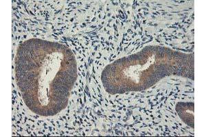 Immunohistochemical staining of paraffin-embedded Human endometrium tissue using anti-CXorf26 mouse monoclonal antibody. (CXorf26 Antikörper)