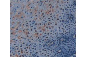 Used in DAB staining on fromalin fixed paraffin- embedded esophagus tissue (TRERF1 Antikörper  (AA 779-936))