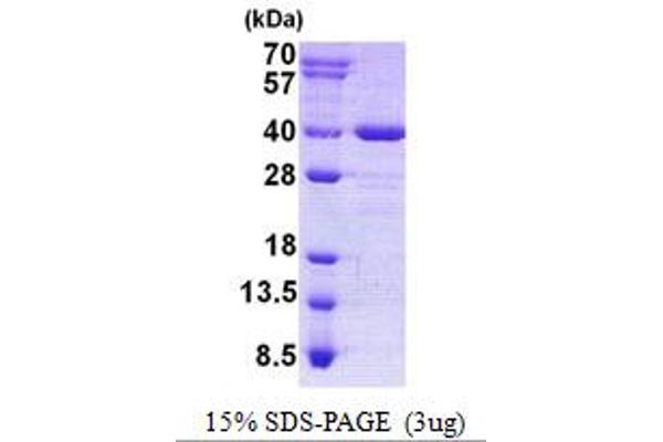 AIDA Protein (His tag)