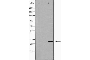Western blot analysis of PPP1R2 expression in Jurkat cells. (PPP1R2 Antikörper  (N-Term))