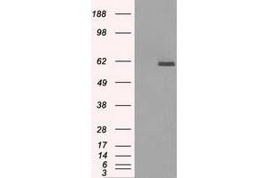 HEK293T cells were transfected with the pCMV6-ENTRY control (Left lane) or pCMV6-ENTRY PPP5C (Right lane) cDNA for 48 hrs and lysed. (PP5 Antikörper)