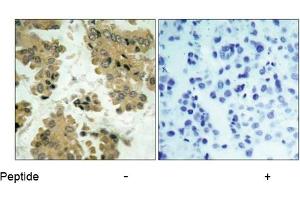 Image no. 1 for anti-V-Akt Murine Thymoma Viral Oncogene Homolog 2 (AKT2) (Ser474) antibody (ABIN197359) (AKT2 Antikörper  (Ser474))
