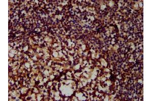 IHC image of ABIN7156645 diluted at 1:300 and staining in paraffin-embedded human tonsil tissue performed on a Leica BondTM system. (MX2 Antikörper  (AA 548-688))