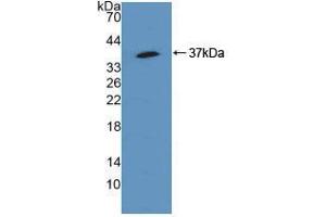 Western blot analysis of recombinant Human SQSTM1. (SQSTM1 Antikörper  (AA 136-400))