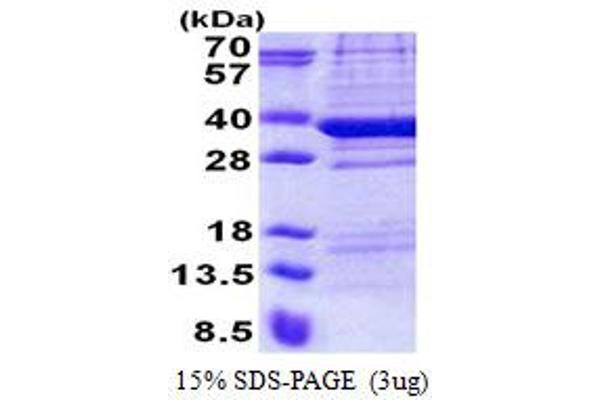 TPGS2 Protein (AA 1-300) (His tag)