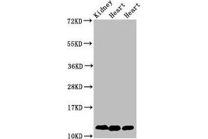 Western Blot Positive WB detected in: Rat kidney tissue, Rat heart tissue, Mouse heart tissue All lanes: CYCS antibody at 2 μg/mL Secondary Goat polyclonal to rabbit IgG at 1/50000 dilution Predicted band size: 12 kDa Observed band size: 12 kDa (Cytochrome C Antikörper  (AA 2-105))