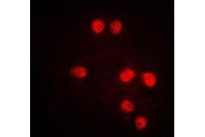 Immunofluorescent analysis of TEL staining in Jurkat cells. (ETV6 Antikörper  (C-Term))