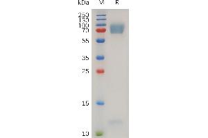 Human AD Protein, His Tag on SDS-PAGE under reducing condition. (ADGRE2 Protein (AA 24-537) (His tag))