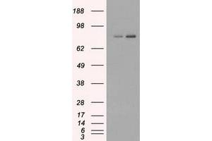 HEK293T cells were transfected with the pCMV6-ENTRY control (Left lane) or pCMV6-ENTRY FERMT2 (Right lane) cDNA for 48 hrs and lysed. (FERMT2 Antikörper)