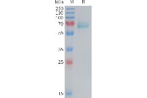Mouse E Protein, His Tag on SDS-PAGE under reducing condition. (EPH Receptor A2 Protein (EPHA2) (AA 26-535) (His tag))