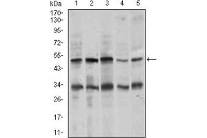 Western blot analysis using CHGA antibody against MOLT4 (1), SK-N-SH (2), HepG2 (3), PC-12 (4), and C6 (5) cell lysate. (Chromogranin A Antikörper  (AA 87-252))