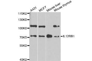 Western Blotting (WB) image for anti-Interleukin 12 Receptor beta 1 (IL12RB1) antibody (ABIN1980210) (IL12RB1 Antikörper)