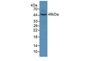 Detection of Recombinant KRT6A, Human using Monoclonal Antibody to Keratin 6A (KRT6A) (KRT6A Antikörper  (AA 163-468))