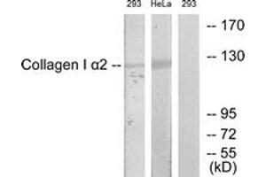 Western blot analysis of extracts from 293/HeLa cells, using Collagen I alpha2 Antibody. (COL1A2 Antikörper  (AA 471-520))