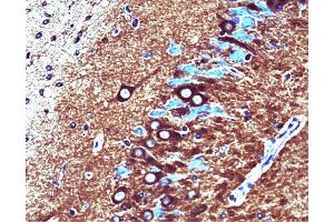 Catalytic alpha (clone 46) staining on rat brain. (PP2A Catalytic alpha (AA 153-309) Antikörper)