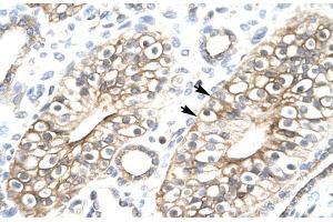 Human kidney; FLJ11730 antibody - N-terminal region in Human kidney cells using Immunohistochemistry (MEAF6 Antikörper  (N-Term))